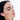 Uneven Tone & Dullness